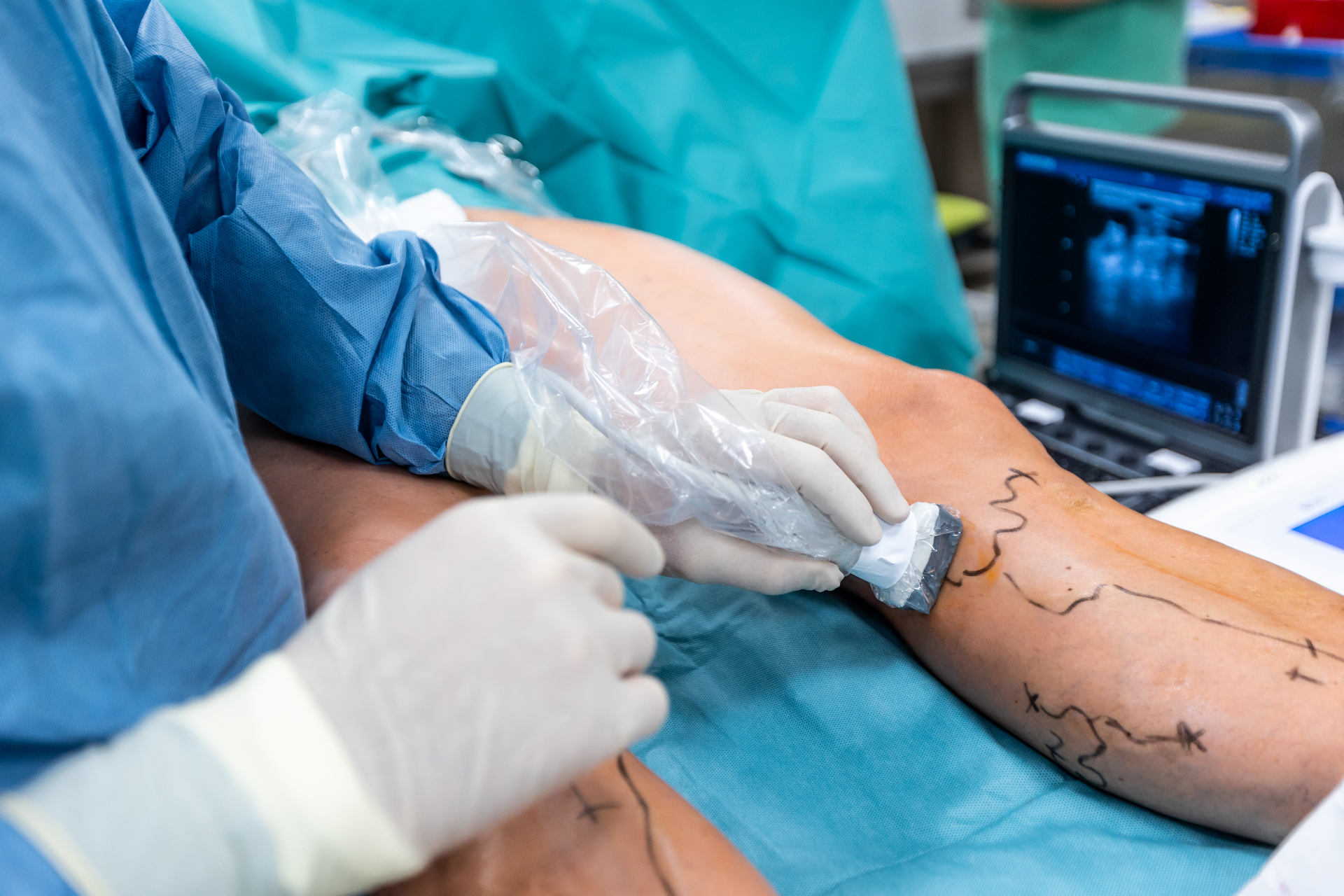 Cirurgia Vascular